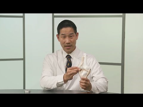 Pediatric Kneecap (Patellar) Dislocations Q&A