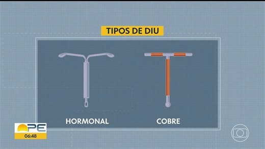 Conheça os tipos de DIU e saiba onde colocar de graça pelo SUS em todo o Estado