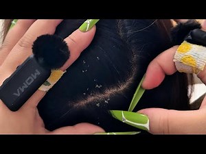 🎧Satisfying Scalp Scratching & Cleaning ASMR | Latte Model | Sleep💤 Relaxation & Stress Relief