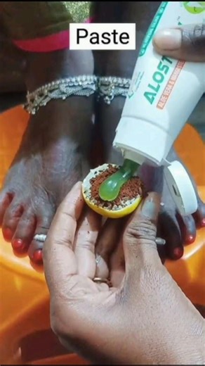 Hand & leg dark spots Removing Easy Home Remedy tips!! #diy #short #ytshorts #falaknaaz #skincare