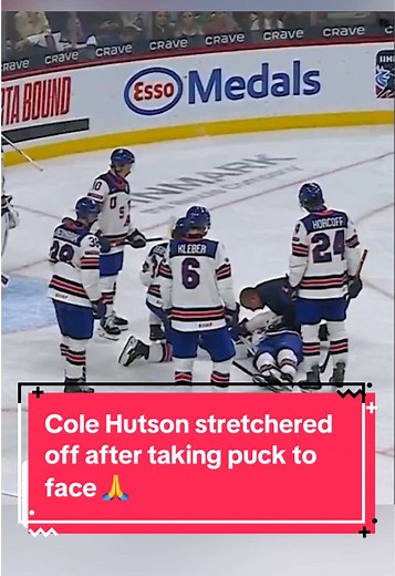 Cole Hutson had to be stretchered off the ice after taking a puck to the head vs. Switzerland. 🙏 He was taken to hospital and is in stable condition. #WorldJuniors
