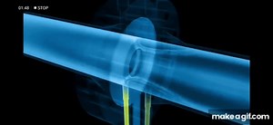 orifice plate working principle on Make a GIF