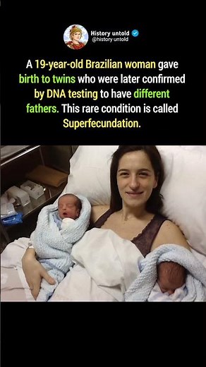 One Pregnancy, Two Fathers: The Science Behind Superfecundation