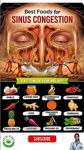Feeling Congested? These foods will clear up your Sinus | #healingfoods #holisticnutrition #sinus