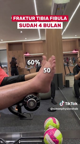 Proses Pemulihan Fraktur Tibia Fibula di Klinik Fisioterapi