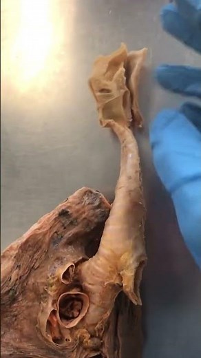 The Inside of a Human "Windpipe"