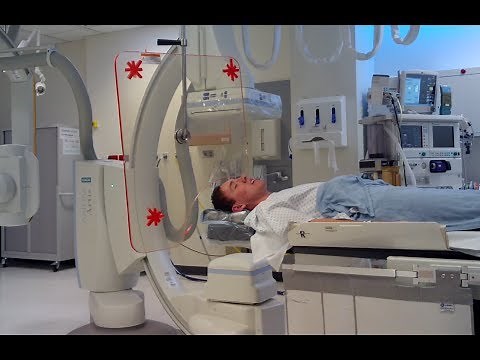 Brain angiogram - Vlog 21 by Samuel Shoesmith