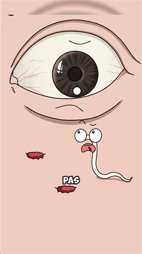 This monstrous worm can live in your EYE! 😱👁️ (Loa loa)