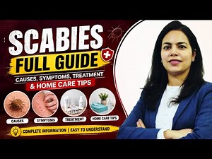Scabies Full Guide | Causes, Symptoms, Treatment & Home Care Tips | Dr. Rashmi Jindal