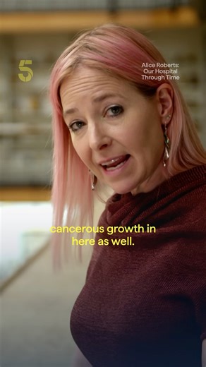 X-rays weren't always so safe to use. Alice Roberts visits the Pathology Museum to uncover their dark history... including the amputated fingers of those who got too close ☢️ 😨 #science #history #NHS | Channel 5
