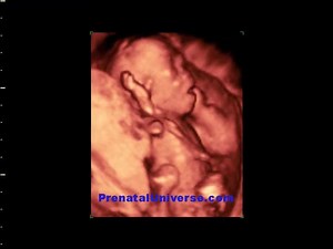 Baby boy at 17 weeks | Prenatal Universe Ultrasound