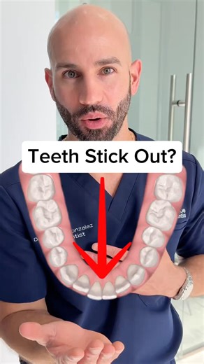 Lower Front Teeth Sticking Out? How Invisalign Fixes It Step by Step