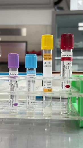 Descubre la importancia de los colores de tubos de muestra en laboratorio clínico