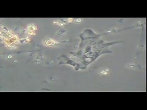 Protozoa in the rhizosphere and on the root surface (1)