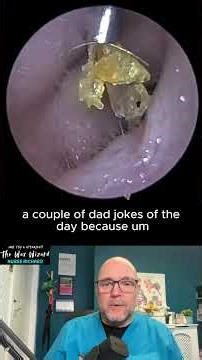 Very a"PEELING' Ear Videos! full video in link below