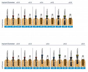 One™ - Adin Implant Line
