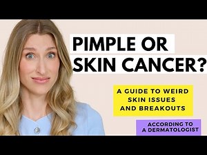 Is Your Pimple Actually Skin Cancer? | Dr. Sam Ellis