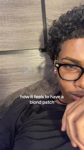 Understanding the Experience of Having a Blond Patch