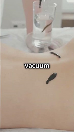 Leech Bite Under the Microscope! 🪱🔬