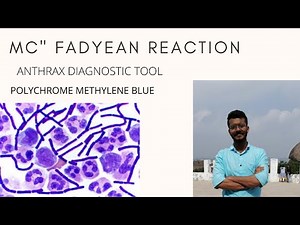 Mc'Fadyean Reaction