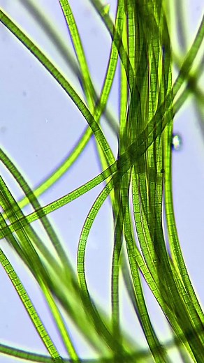 Cyanobacteria 🌱 #microscope #science #microscopio #biology #🔬 #bacteria #fyp #nature #scienceismagic #life #fypシ #green #pond #wow #small #macro #fy