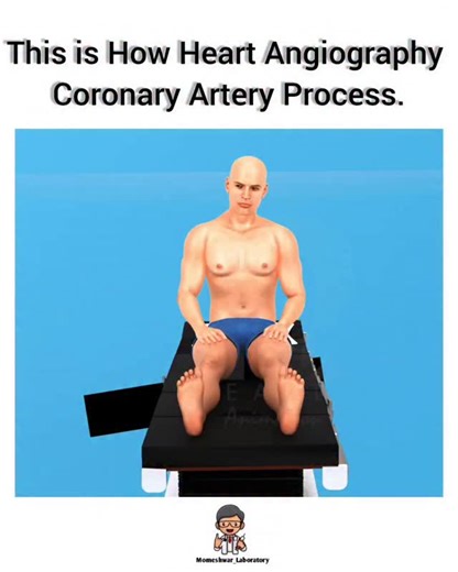 𝐌𝐨𝐦𝐞𝐬𝐡𝐰𝐚𝐫 𝐋𝐚𝐛𝐨𝐫𝐚𝐭𝐨𝐫𝐲 𝐃𝐡𝐚𝐧𝐞𝐫𝐚 on Instagram: "Heart Coronary artery Angiography. Process 🏥💉 Angiography is a medical imaging test that uses X-rays and a special contrast dye to create detailed pictures (angiograms) of blood vessels, revealing blockages, narrowing, or other problems in arteries and veins throughout the body, from the heart (coronary arteries) to the legs, brain, and lungs, helping doctors diagnose conditions like heart disease or aneurysms and plan treat