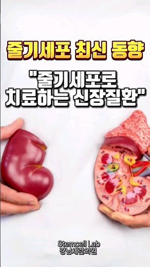 #줄기세포 #줄기세포치료 #줄기세포최신동향 #신장질환 #신장이식 #사구체신염 #급성신부전증
