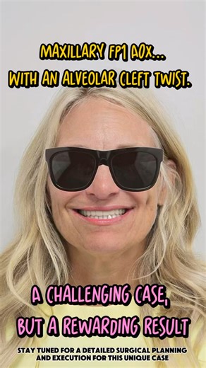 Maxillary FP1 case with an Alveolar Cleft