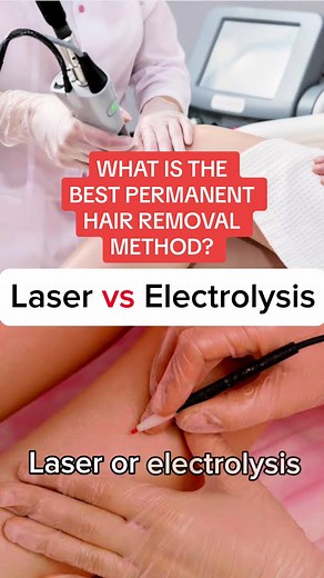 What is the best permanent hair removal method? #hairremoval #hairremovalhacks #hairremovallaser #hairremovaltreatment #damagefreehair #electrolysis #electrolysishairremoval #madamesweat #madamesweatisconcerned