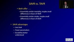 Update in TAVR (and Other Valves)
