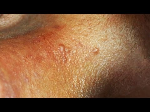 Sophia Skin Care Deep Relaxing #31