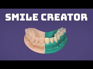 Smile Creator Module for exocad DentalCAD | Create Beautiful Smiles