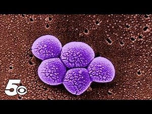 New recommendations for preventing the transmission of MRSA