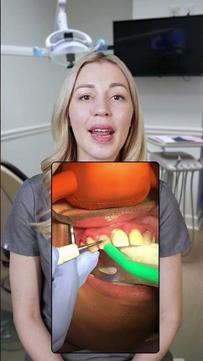 What’s Scaling and Root Planning? #dentist #dentistadvice #dentistexplains #greenscreen #dentisttip