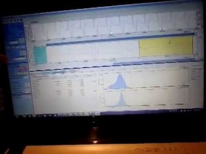 Biofeedback for calming the heart nervousness anxiety