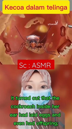 ASMR animation of removing a cockroach from inside the ear #shorts #asmr