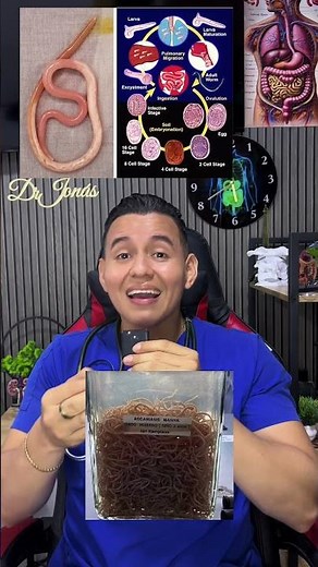 Ascaris lumbricoides🪱 #parasites #infection #wellness