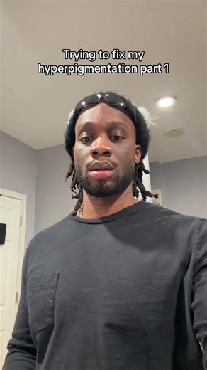 Effective Hyperpigmentation Treatments Explained