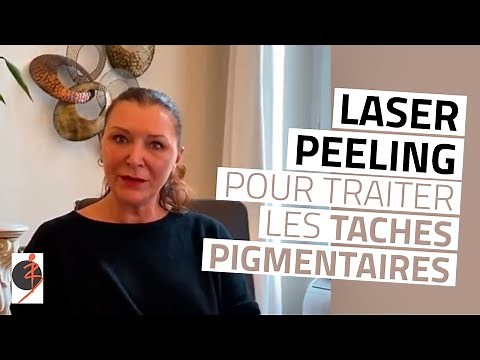 Traitement des taches pigmentaires avec laser ou peeling chez le Dr Navarro à Aix-en-Provence