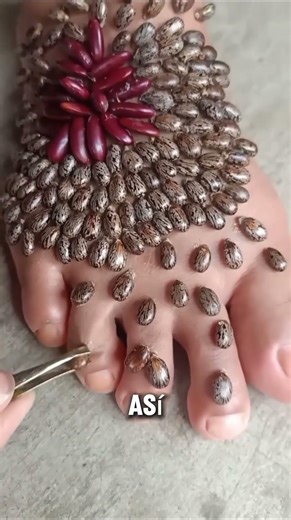 Nunca hagas esto si pisas un erizo de mar ⚠️