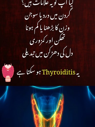Do you have these symptoms? Neck pain, swelling, tiredness, weight changes 💡 They could be signs of Thyroiditis. Don’t ignore them #Thyroiditis #ThyroidHealth #ThyroidAwareness #HealthTips #DoctorOnTikTok