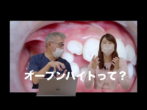 オープンバイト（開咬）歯に力がかかりやすい噛み合わせ