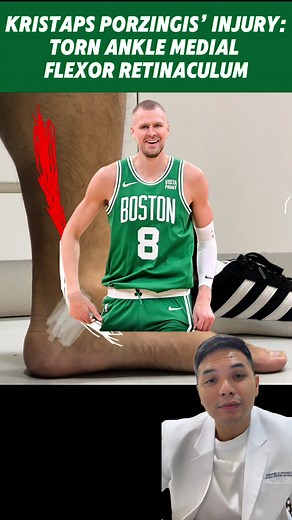 Kristaps Porzingis Ankle Injury: Torn Medial Retinaculum & Subluxation - Rehabilitation and NBA Updates