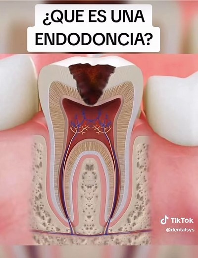 Dental SyS on TikTok