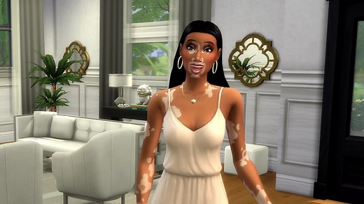 Vitiligo Skin Feature in The Sims 4