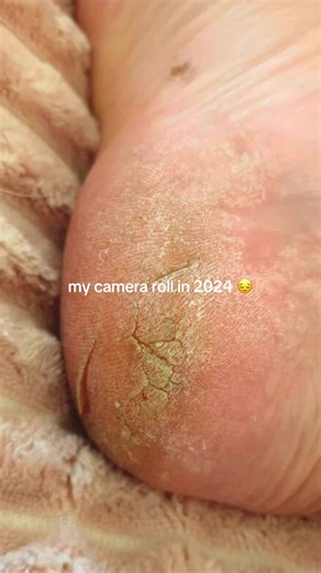 LOVE me some nice feet 😮‍💨 #feet #foot #skincare #footfile #exfoliate #skincaretools #skincarehacks #footcare