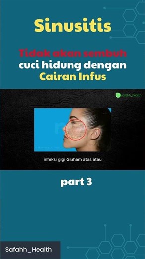 Cuci Hidung Cairan Infus Tidak akan Sembuh (3) #safahhhealth #sinusitis #irigasinasal