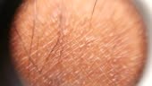 Close up of Human Skin Texture