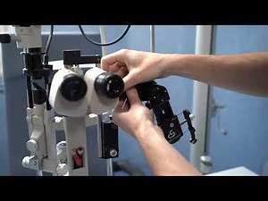 New Generation of MicroREC - How to install to a Slit Lamp