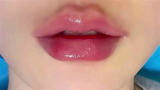 violet心形唇部提升